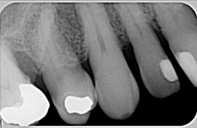 Sans titre qqcmdl - Eugenol
