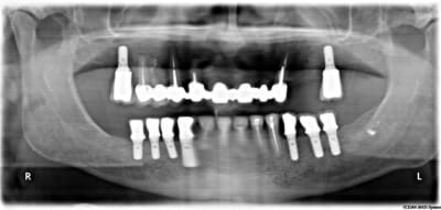 Sans titre zpvem2 - Eugenol