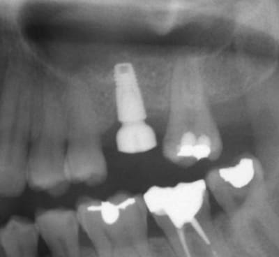 Screenshot014 kg9b9n - Eugenol