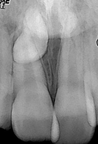 Screenshot047 ufbw8k - Eugenol