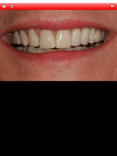 Screenshot acqdww - Eugenol