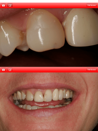 Screenshot v0rxj2 - Eugenol