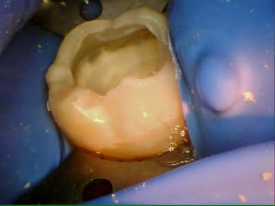 Stillcap0014 har0dq - Eugenol