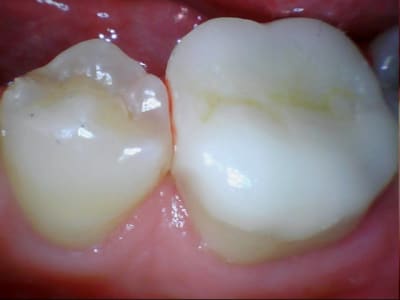 Stillcap0032 bycxwy - Eugenol