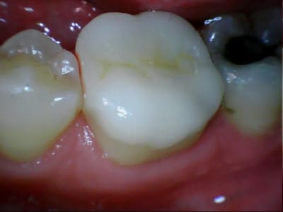 Stillcap0033 o8wzms - Eugenol