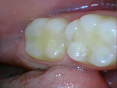 Stillcap0044 idqsam - Eugenol