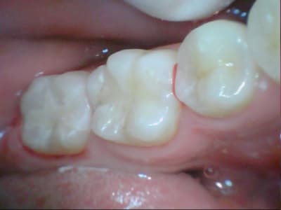 Stillcap0049 ob6ncz - Eugenol