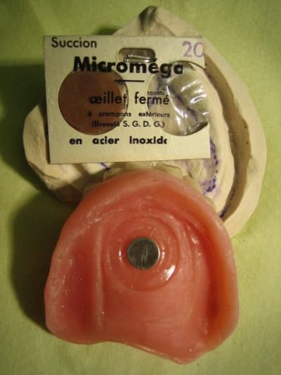 Succion eqdbyw - Eugenol