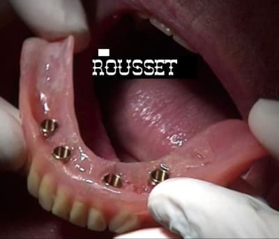 Syncone k69nvz - Eugenol