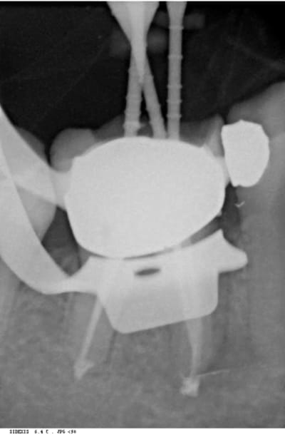 Trev2 c5sddm - Eugenol