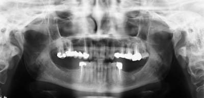 Ted chris izwhvh - Eugenol