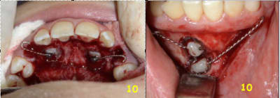 Test canines 10 olvdlx - Eugenol