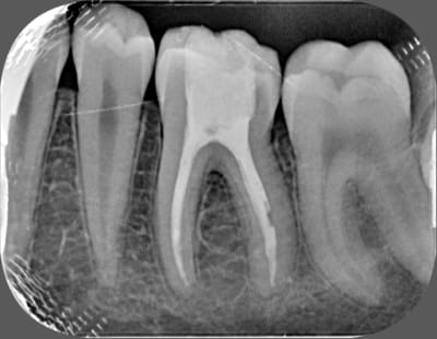 Unknown x 2013 06 04 09 27 48 3 d5zxvr - Eugenol