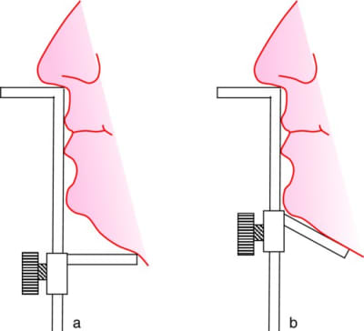 Willis sdu6z7 - Eugenol