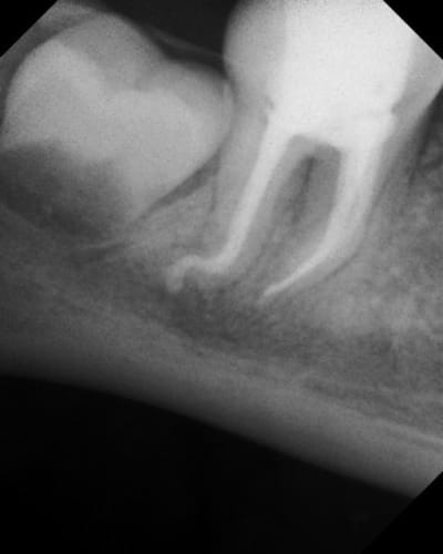 X04908 bfss1q - Eugenol