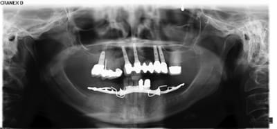 X5064903 elrirr - Eugenol
