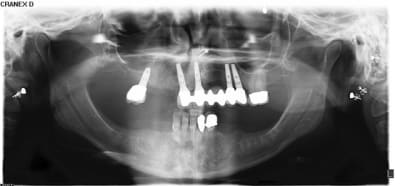 X5064912 hvwest - Eugenol