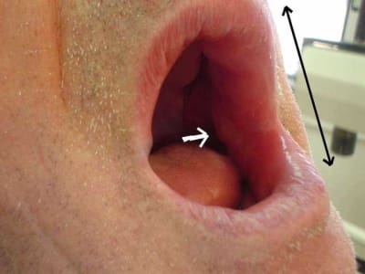 Zona du v3 vue interne fen0f8 - Eugenol