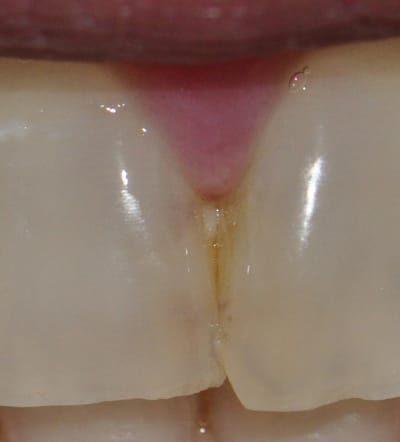  dsc0005  kwfyvn - Eugenol