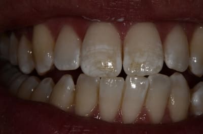  dsc2021 nwzmcy - Eugenol