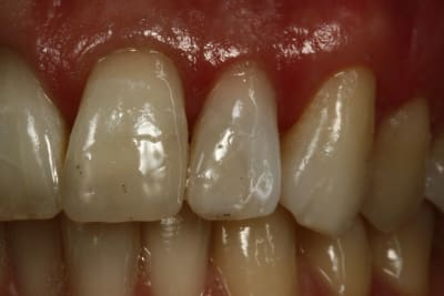  mg 1445 xjybg2 - Eugenol