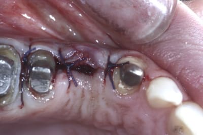  mg 1539 ohw3ll - Eugenol