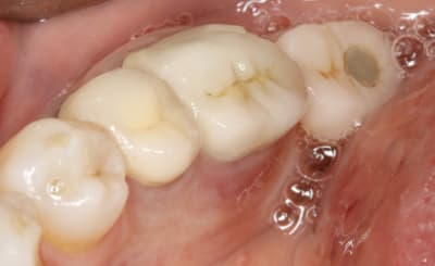  mg 1563 yvbw5u - Eugenol