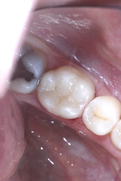  mg 1648 awov7i - Eugenol