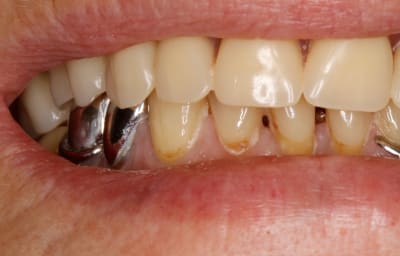  mg 1804 yeyu6a - Eugenol