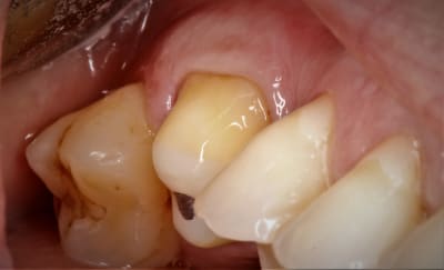  mg 2015 u6fxyf - Eugenol