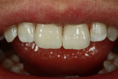  mg 3625 zxosv1 - Eugenol