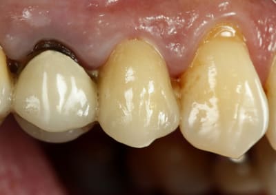  mg 4981 betxzf - Eugenol