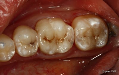  mg 5047 001 zhykl5 - Eugenol