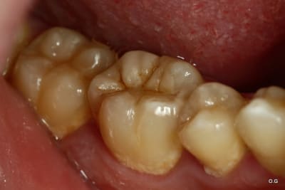  mg 5091 rijxb8 - Eugenol