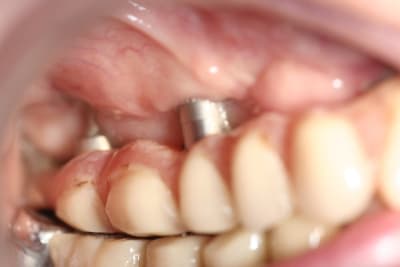  mg 6232 pl0xv1 - Eugenol