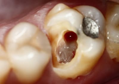  mg 6968 qhr1nd - Eugenol