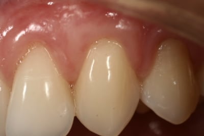  mg 7581 eyguoo - Eugenol