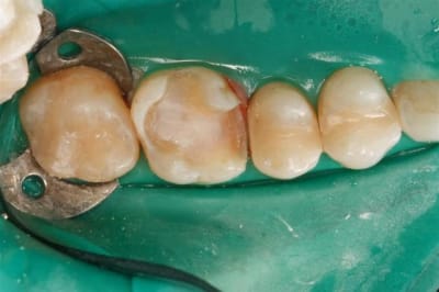  mg 7743  large  l8dk0o - Eugenol