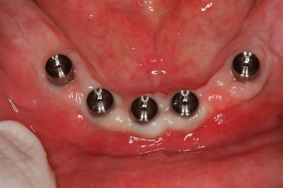  mg 9384  large  b0xjko - Eugenol