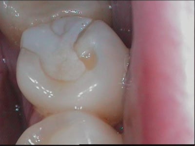  at 21 02 16 375  025 img s  vyjrns - Eugenol