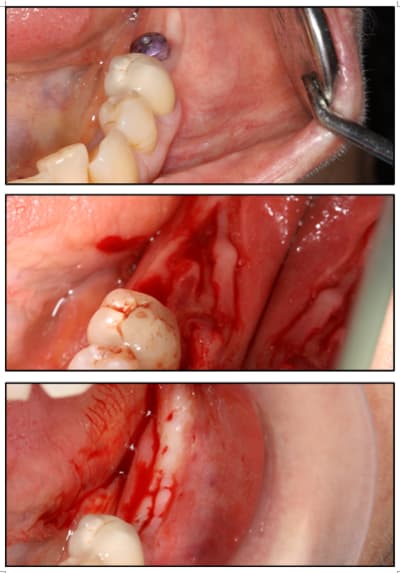 A2 pcgwcj - Eugenol