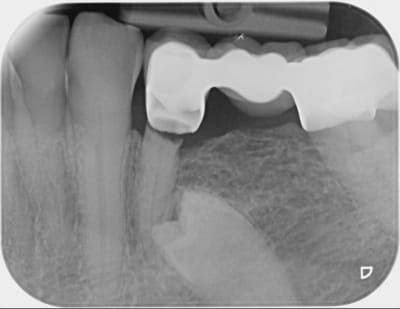 A   copie fzxxpc - Eugenol