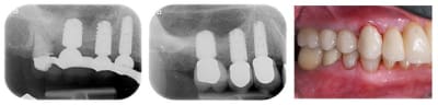 A  1  hfegiu - Eugenol