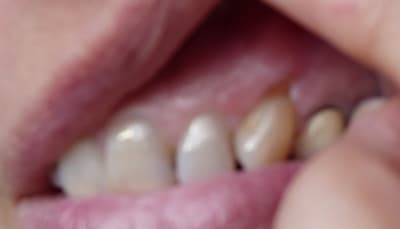 A pof9mt - Eugenol