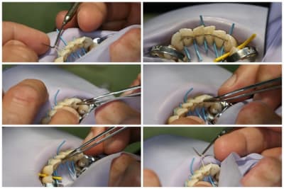 Adaptation fil vqdyl3 - Eugenol