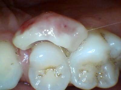 Aeiq8dazylrxbmihs8nr - Eugenol