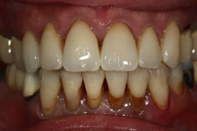 Aie  1  pc1kfk - Eugenol