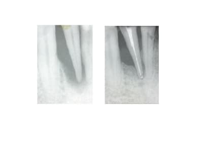 Al2 awn5ru - Eugenol