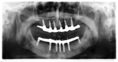All c5nfvb - Eugenol