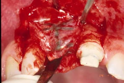 Amant3 aqjpwu - Eugenol